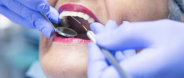 Best Emergency Dental Extractions in Gastonia, NC